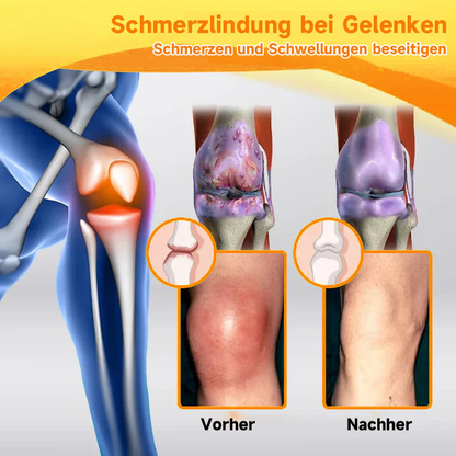 BeeLixir™ – Bijengifcrème met hyaluron & collageen voor intensieve verzorging & regeneratie [1 + 1 Gratis]
