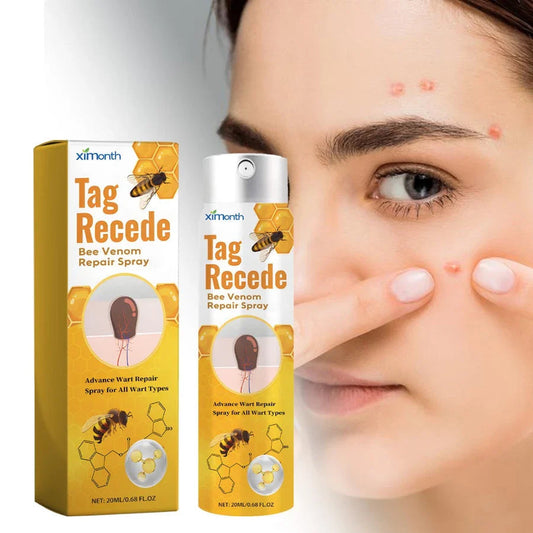 TagAway™ – Effectieve verwijdering van wratten & huidgroei voor een gladde, heldere huid [1 + 1 Gratis]