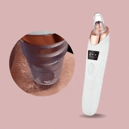 ClearVibe™ - Mee-eters verwijderaar [50% Korting]