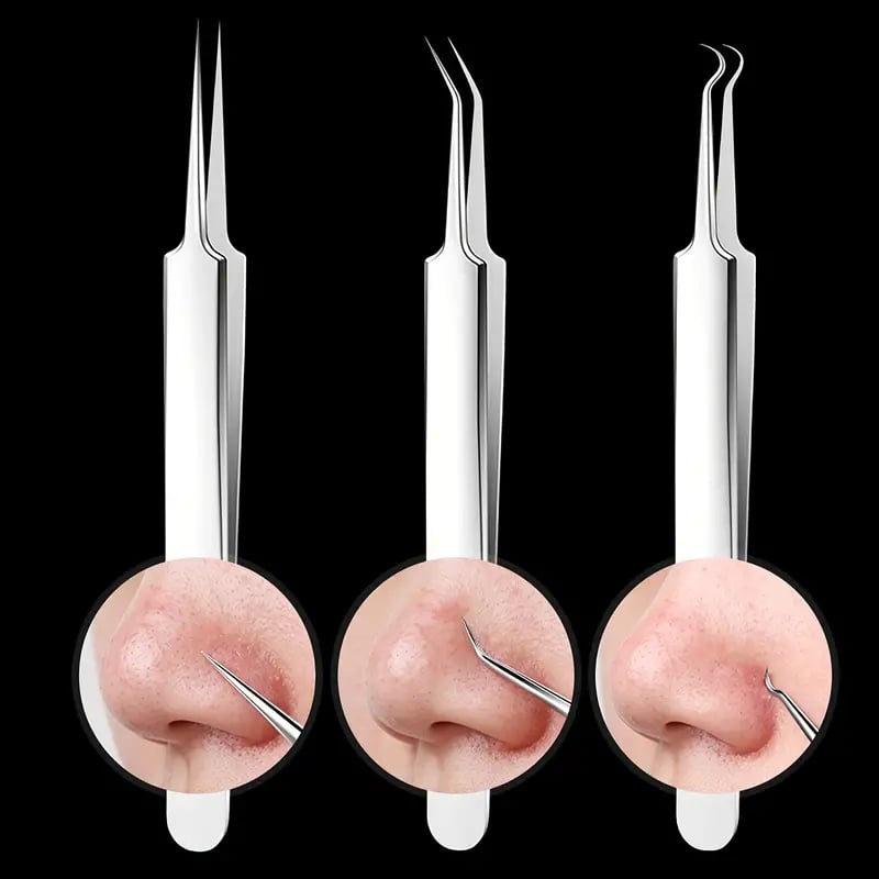 ClearPore™ Mee-eter Verwijderset – Professioneel Pincet voor Acne & Poriën
