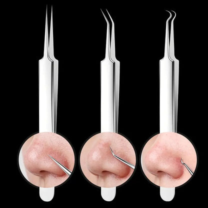 ClearPore™ Mee-eter Verwijderset – Professioneel Pincet voor Acne & Poriën