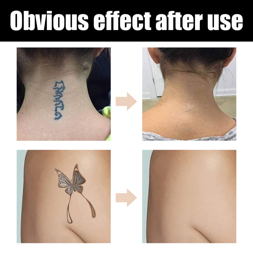 DermaVeil™ – Waterdichte bedekking voor tatoeages en littekens met een natuurlijke finish [1 + 1 Gratis]