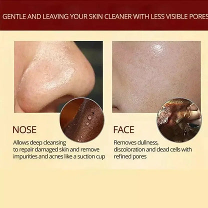 HerbalMask™ – Verfijnend peel-off gezichtsmasker zacht, effectief en kalmerend [1 + 1 Gratis]