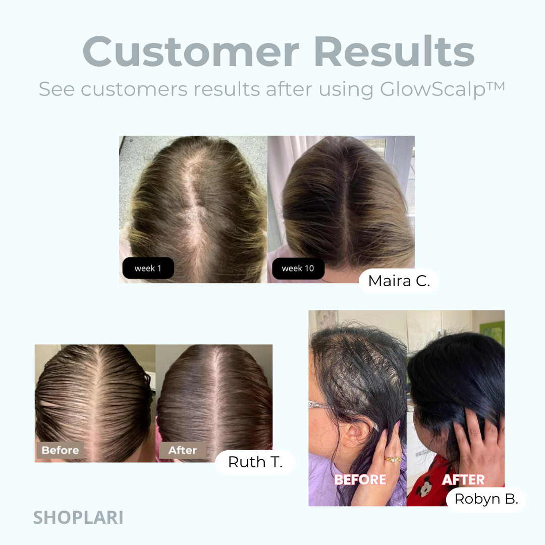 GlowScalp™ – Hoofdmassageborstel met Lichttherapie voor Haargroei & Gezonde Hoofdhuid