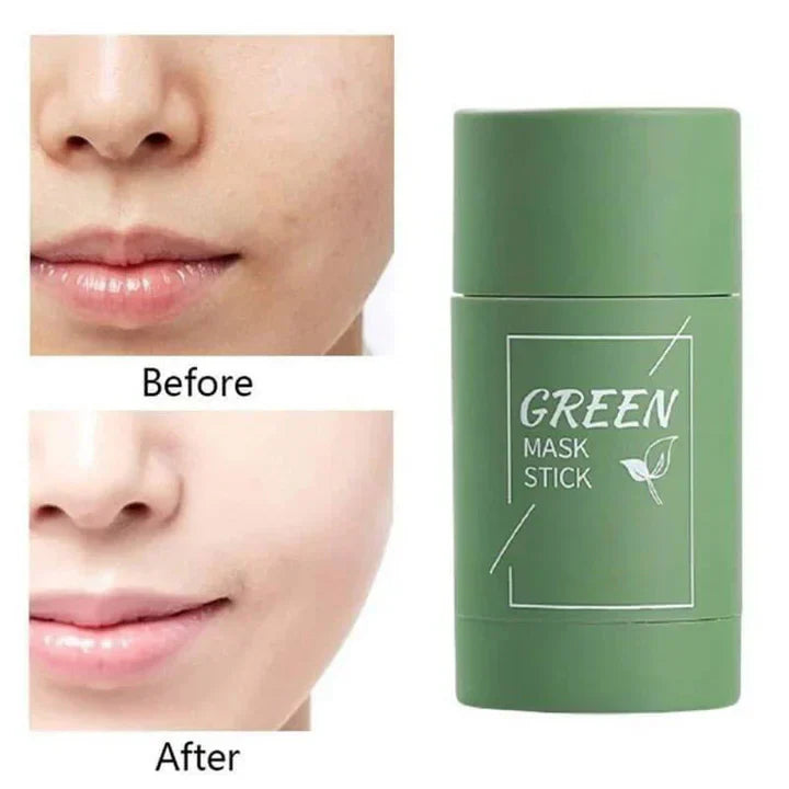 DermaTea™ – Groene Thee Masker Stick voor Diepe Poriënreiniging [1+1 Gratis]