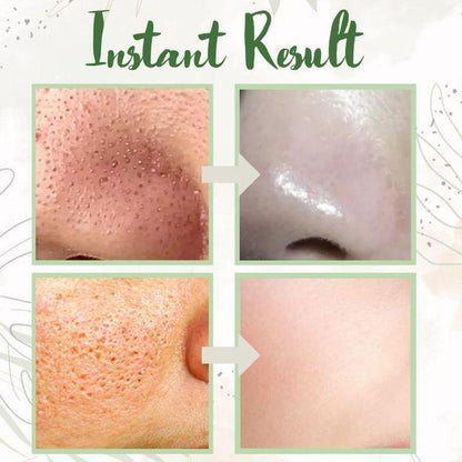 DermaTea™ – Groene Thee Masker Stick voor Diepe Poriënreiniging [1+1 Gratis]