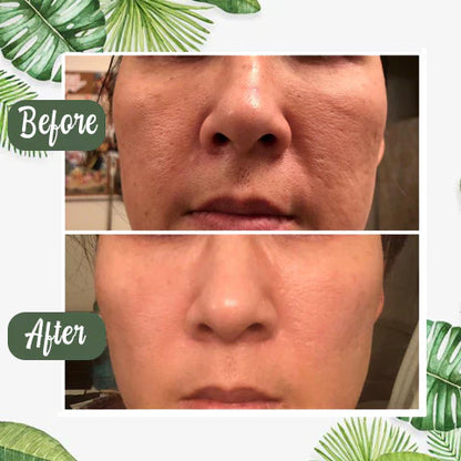 DermaTea™ – Groene Thee Masker Stick voor Diepe Poriënreiniging [1+1 Gratis]