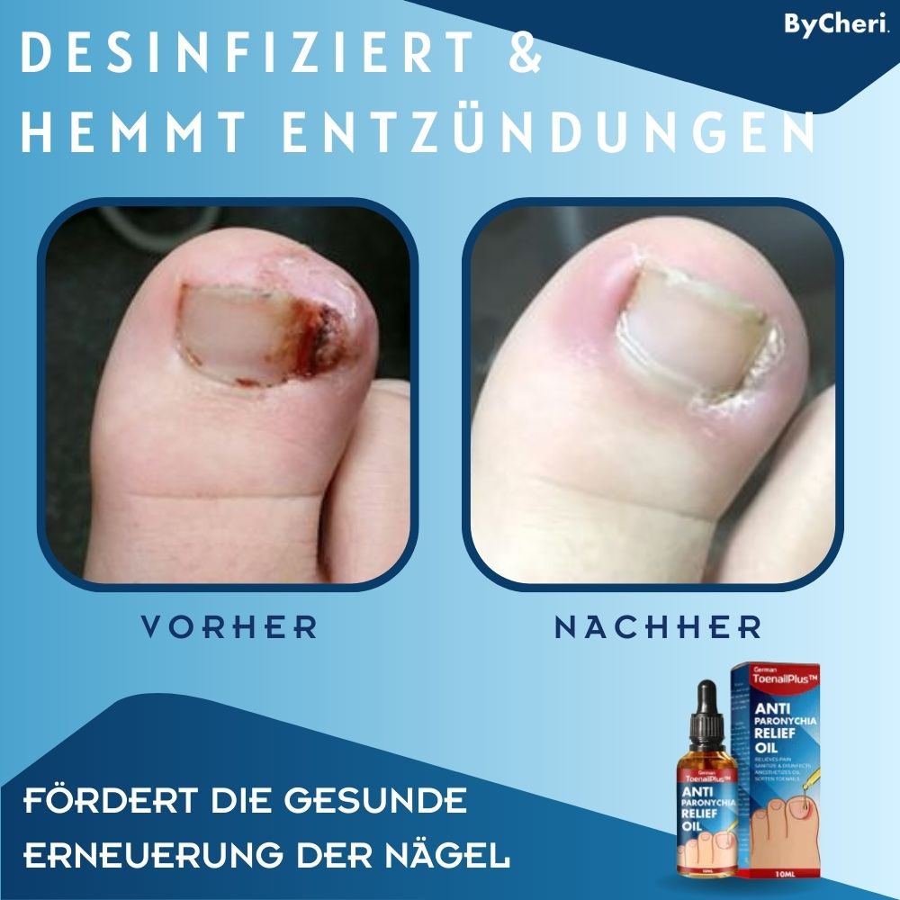 HeilungsTropfen™ - Herstel beschadigde nagels in 4 weken [1 + 1 Gratis]