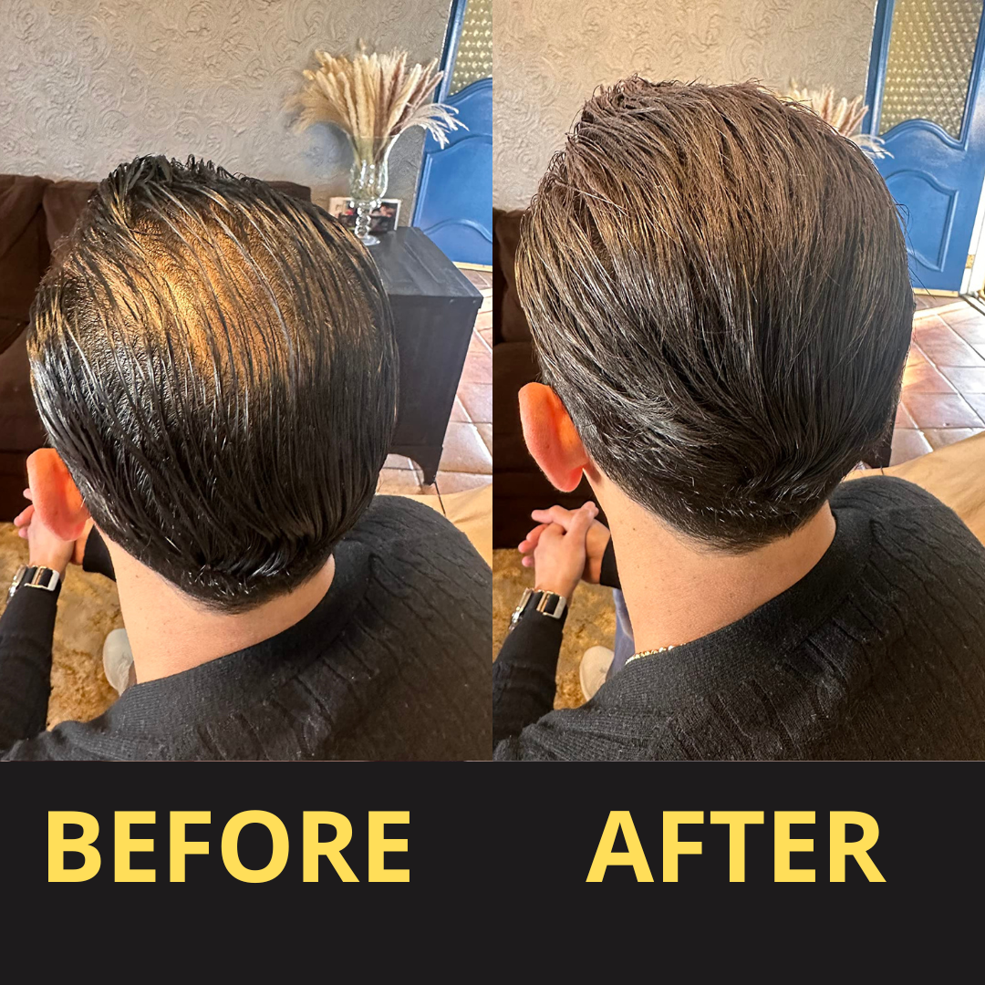 ColorSeal – Haarverdichtingspoeder voor direct voller haar [1 + 1 Gratis]