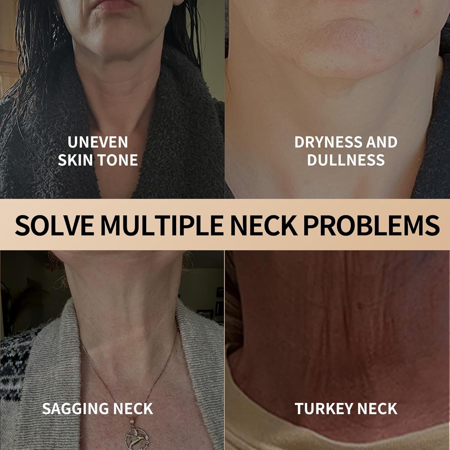 NeckLuxe™ - Krijg een steviger, meer gedefinieerd decolleté! [1 + 1 Gratis]