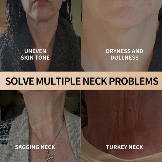NeckLuxe™ - Krijg een steviger, meer gedefinieerd decolleté! [1 + 1 Gratis]