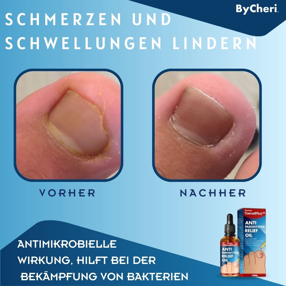 HeilungsTropfen™ - Herstel beschadigde nagels in 4 weken [1 + 1 Gratis]