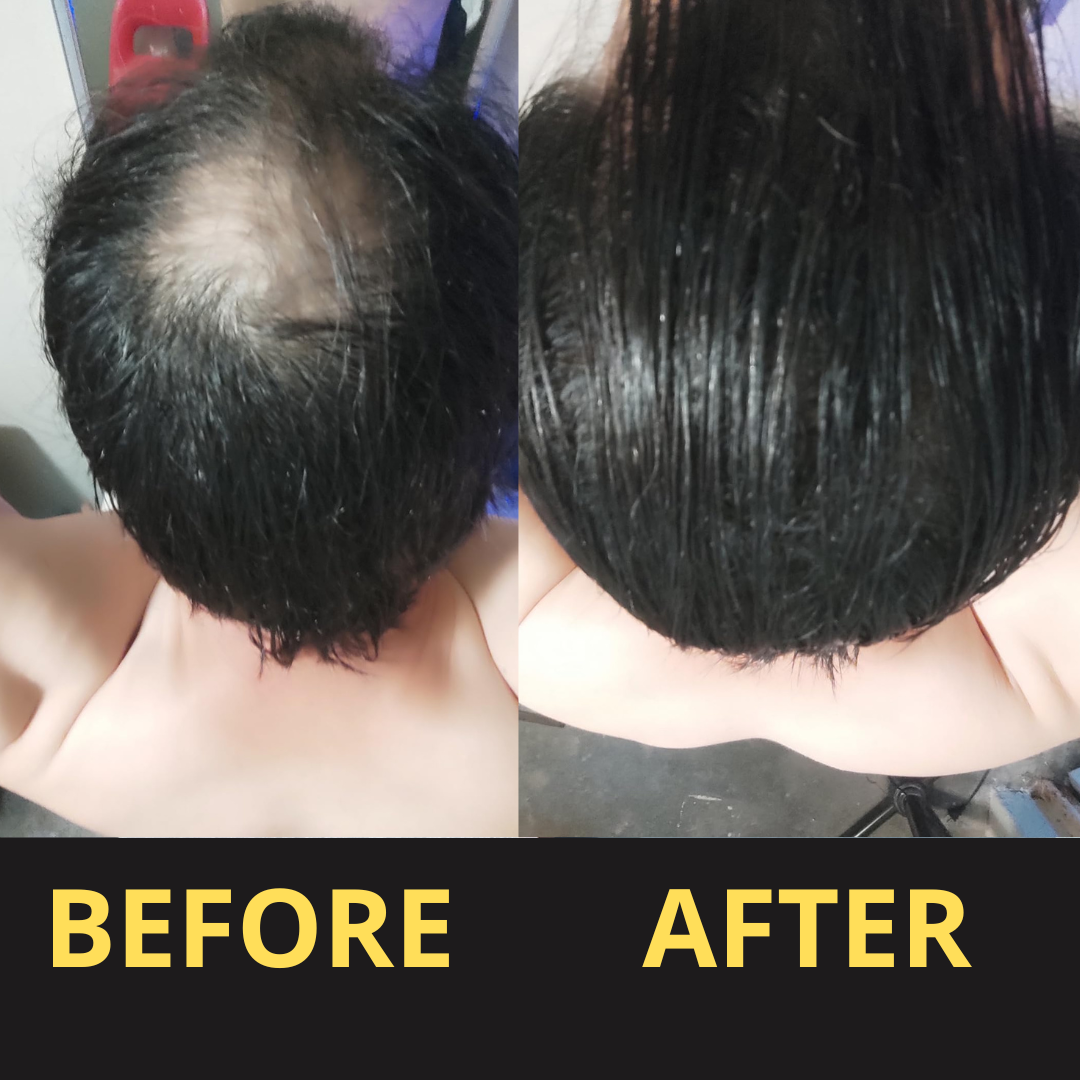 ColorSeal – Haarverdichtingspoeder voor direct voller haar [1 + 1 Gratis]