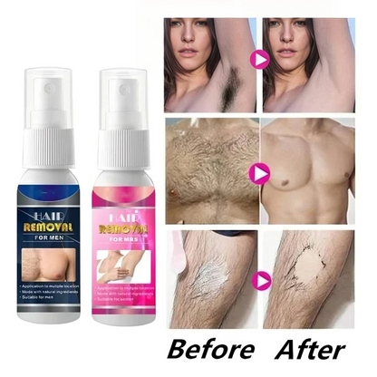 BareMist™ Ontharingsspray – Pijnloos & Langdurig Glad [1+1 Gratis]
