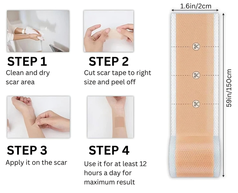Dermiva™ – Zachte Siliconenpleisters voor Littekens [1 + 1 Gratis]