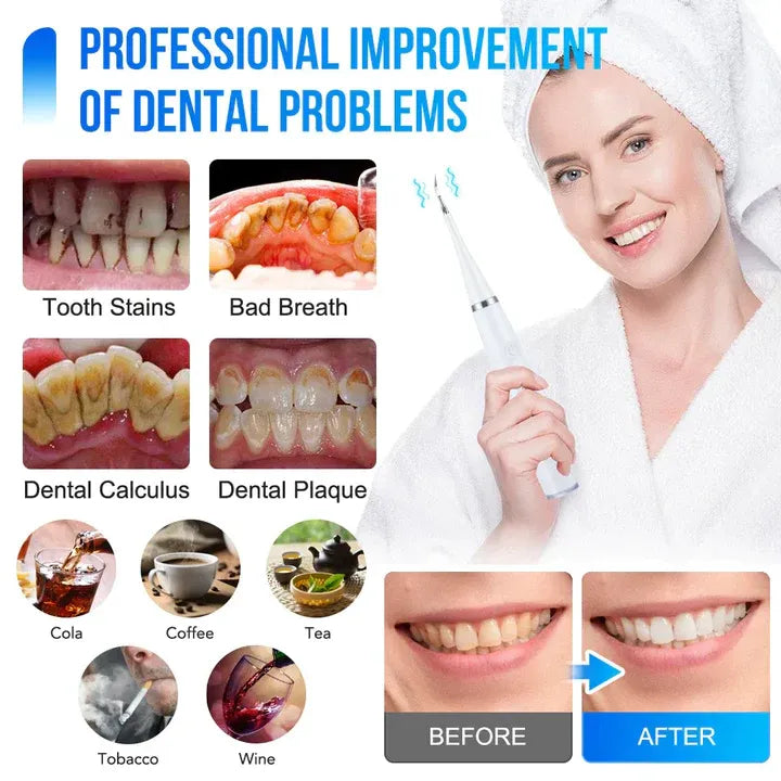 ToothCleaner™ – Effectieve verzorging voor stralend gezonde tanden! [50% Korting]