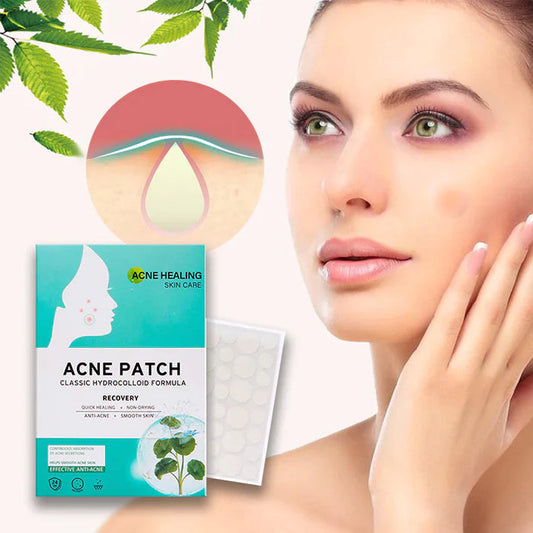 AcNatch – Pleister voor het verwijderen van acne en huidonzuiverheden voor een heldere huid [50% Korting]