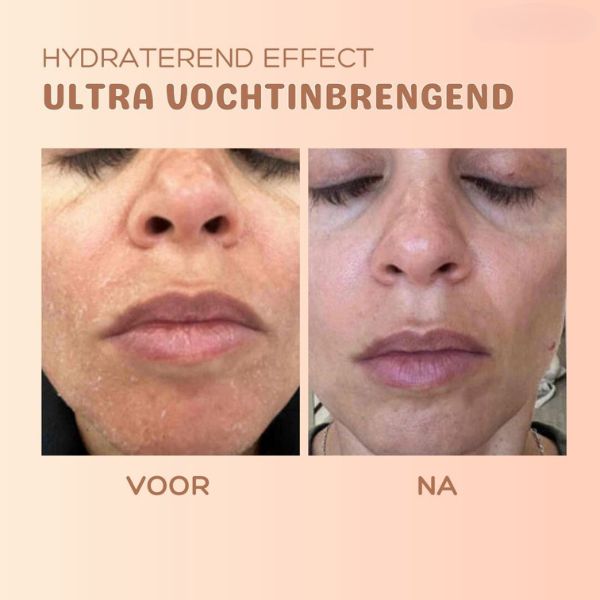 MultiBalm™ - Balsem om de huid te vernieuwen tegen rimpels [1 + 1 Gratis]