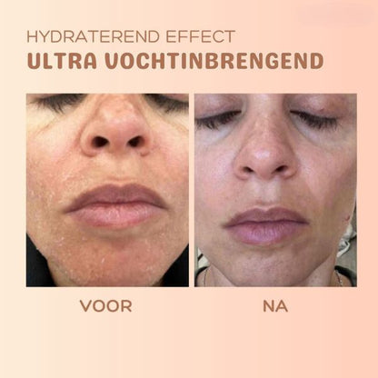 MultiBalm™ - Balsem om de huid te vernieuwen tegen rimpels [1 + 1 Gratis]