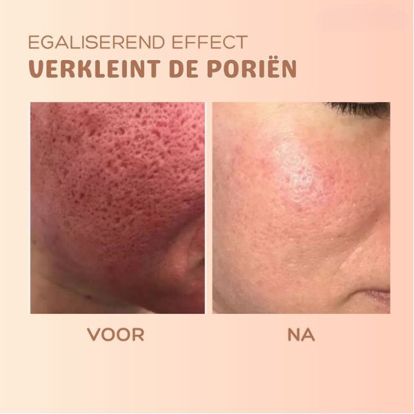 MultiBalm™ - Balsem om de huid te vernieuwen tegen rimpels [1 + 1 Gratis]