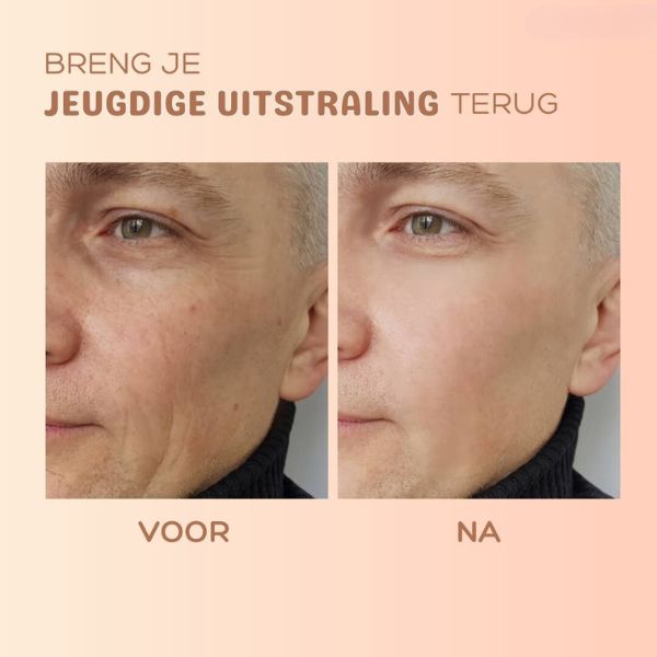 MultiBalm™ - Balsem om de huid te vernieuwen tegen rimpels [1 + 1 Gratis]