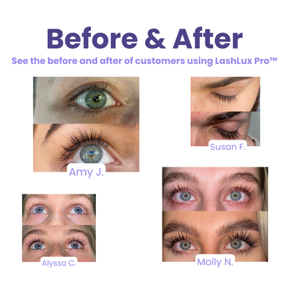 LashLux™ -  Wimpergroeiserum [1 + 1 Gratis]