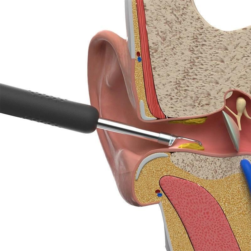 EarScope™ – Draadloze endoscoop-oorreinigingscamera voor nauwkeurige & veilige reiniging [50% Korting]