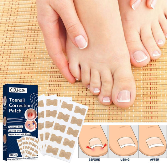 NailLift™ – Correctie-pads voor ingegroeide teennagels, eenvoudig te gebruiken en beschermend [1 + 1 Gratis]