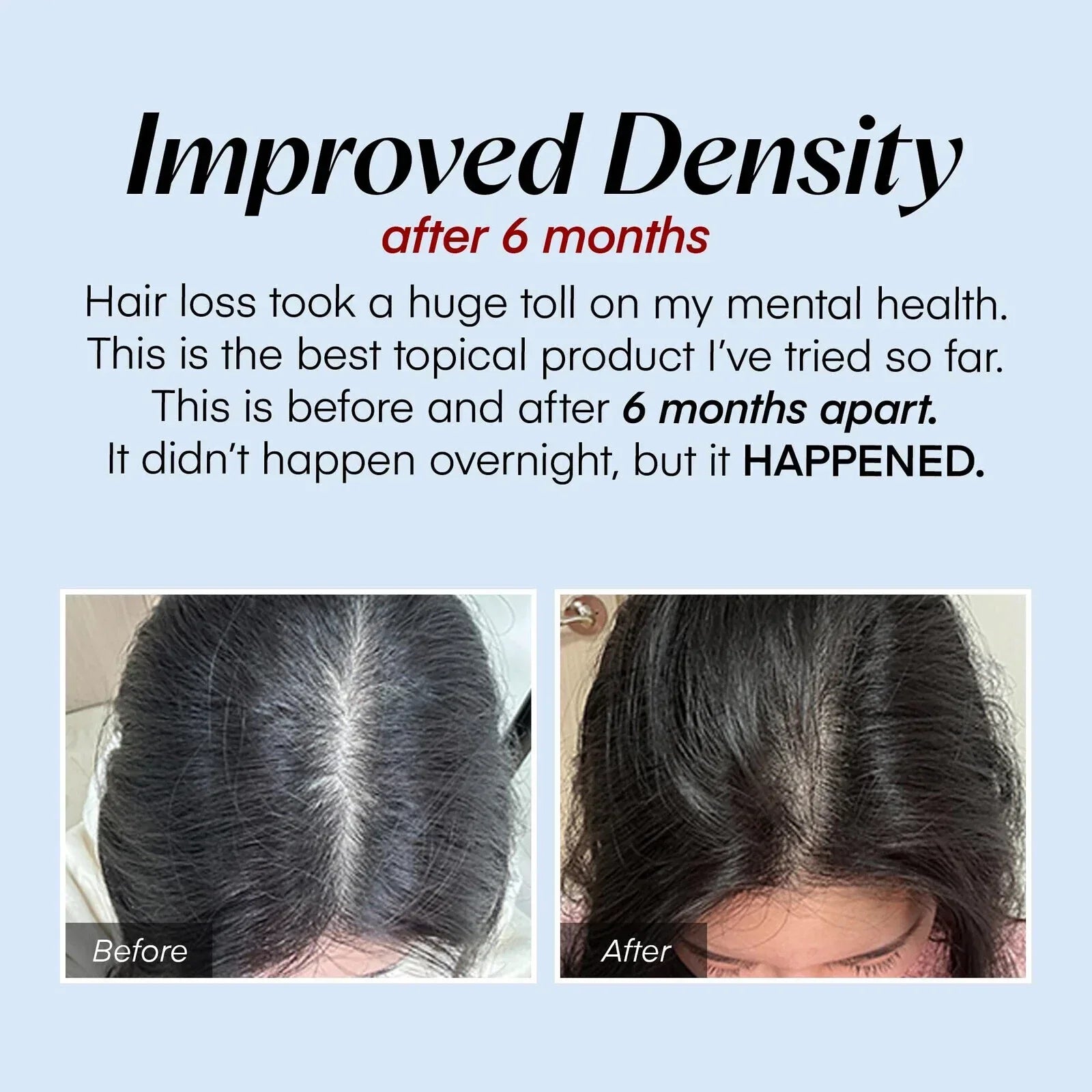 HairRevive™ - Ervaar de kracht van direct haarherstel en voeding! [1 + 1 Gratis]