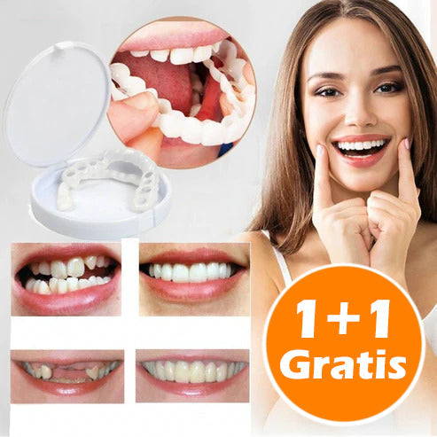 1 + 1 Gratis | SmileFix™ Creëer het perfecte gebit [Laatste dag korting]