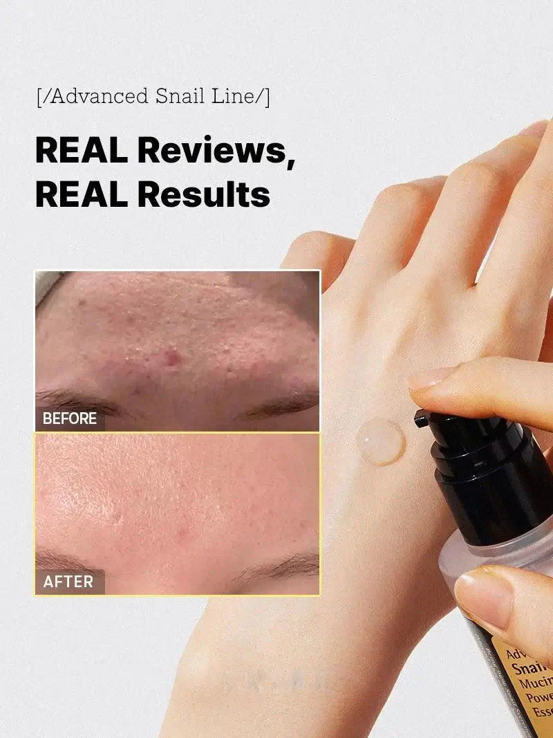 GlowFace™ – 96,3% slakkenslijm, huidregeneratie en intensieve hydratatie [50% Korting]