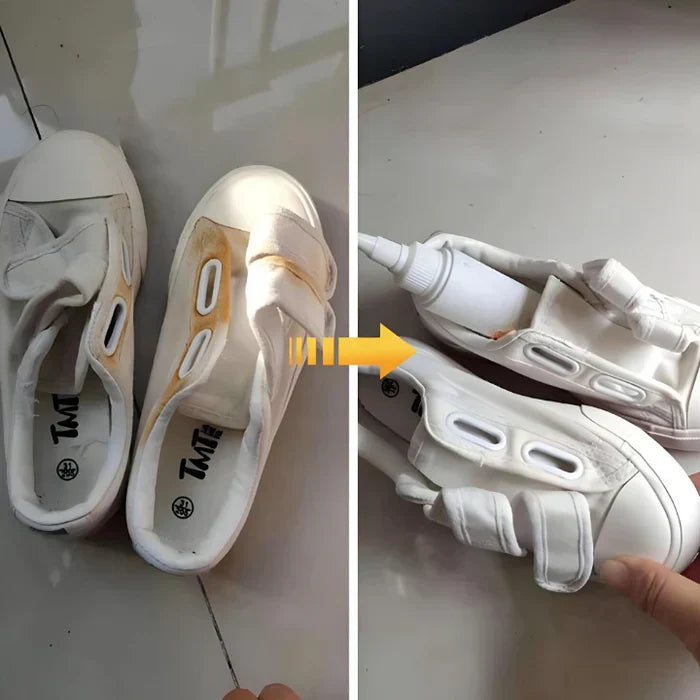 SpotGone™ - Vlekverwijderaar [1 + 1 Gratis]