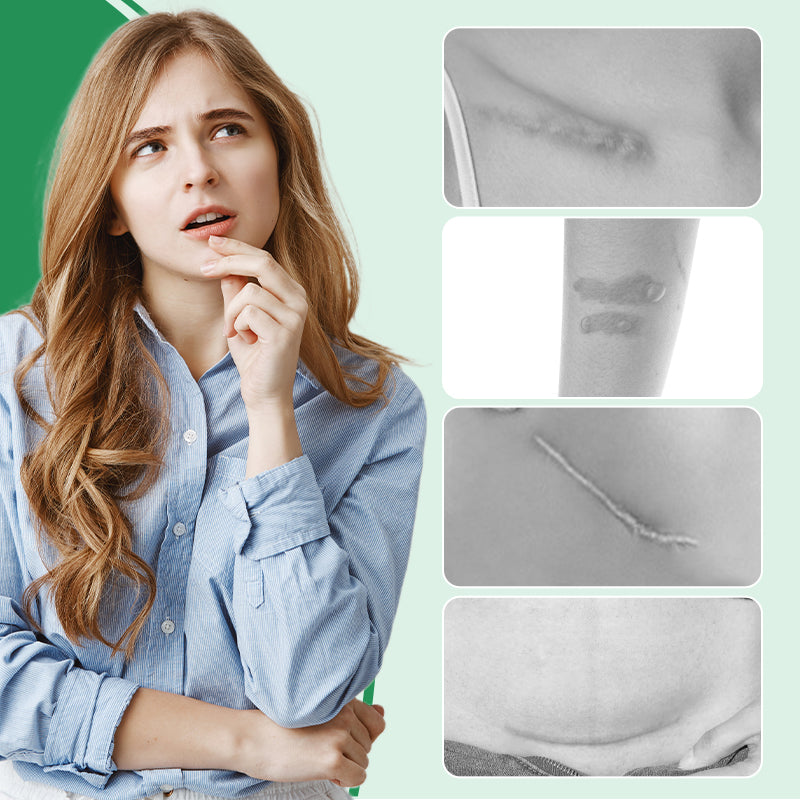 Scarify™ – Herbruikbare siliconen littekenpleisters voor een gave huid [1 + 1 Gratis]