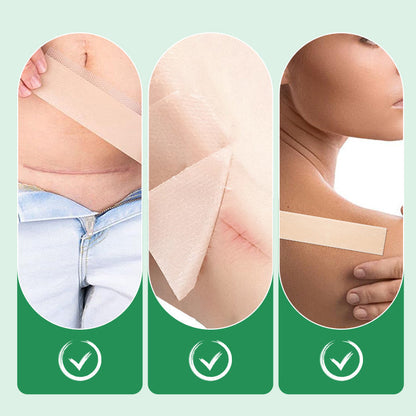 Scarify™ – Herbruikbare siliconen littekenpleisters voor een gave huid [1 + 1 Gratis]