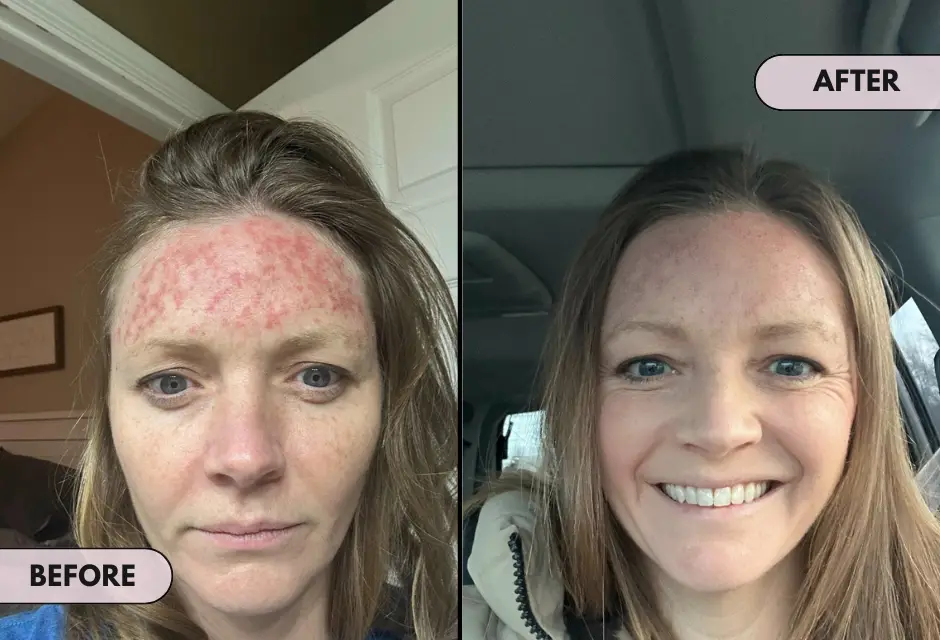 GlowGuard™ – Huidtint corrigerende CC-crème met SPF 43 voor een stralende huid [1 + 2 Gratis]