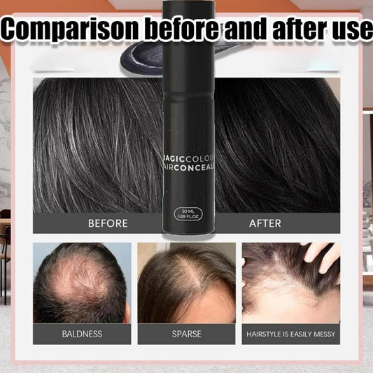 HarLani™ – Directe Haarbedekking voor een natuurlijke, volle & verzorgde look [1 + 1 Gratis]