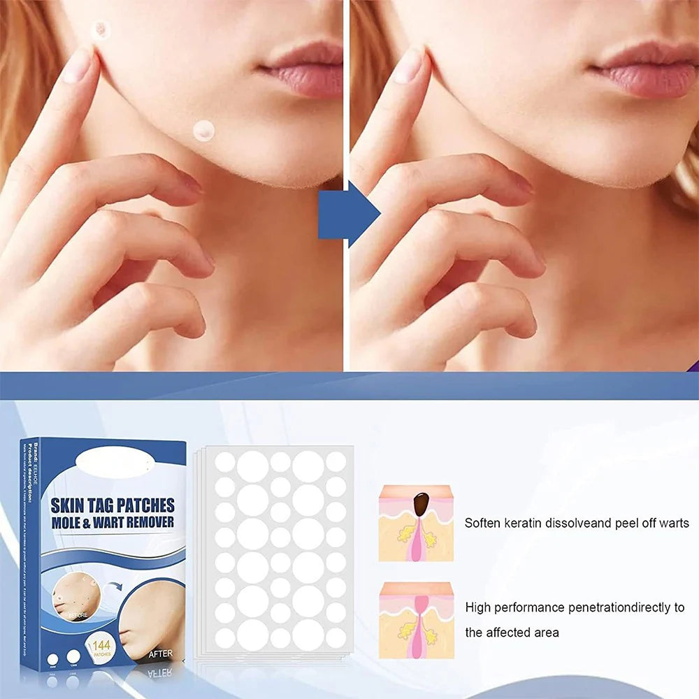 SkinPatch™ – Pijnloze, niet-invasieve behandeling voor zichtbaar heldere, gezonde huid [1 + 1 Gratis]