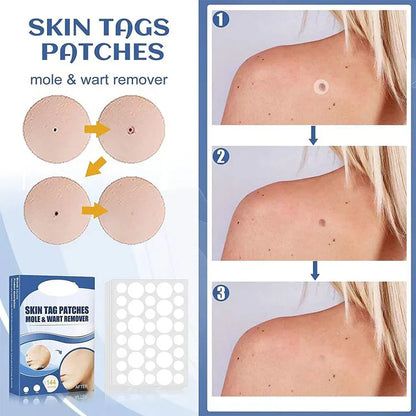 50% korting | TagAway™ - Pleisters voor het verwijderen van huidtags en wratten [laatste dag korting]
