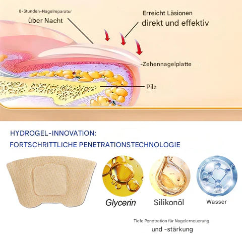 Nailox™ - Effectieve behandeling van schimmelnagels [1 + 1 Gratis]