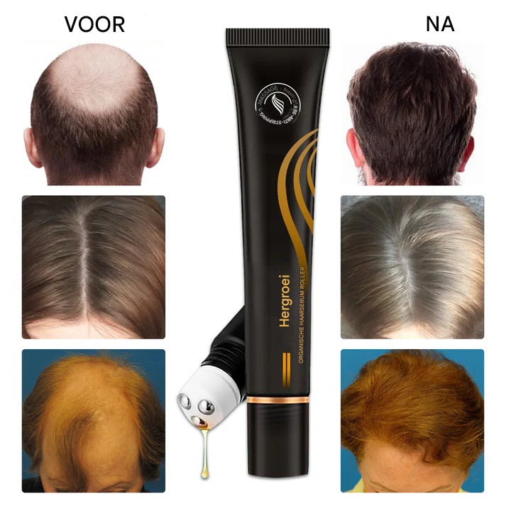 Follicyn™ - Biologisch haarserum roller [1 + 1 Gratis]