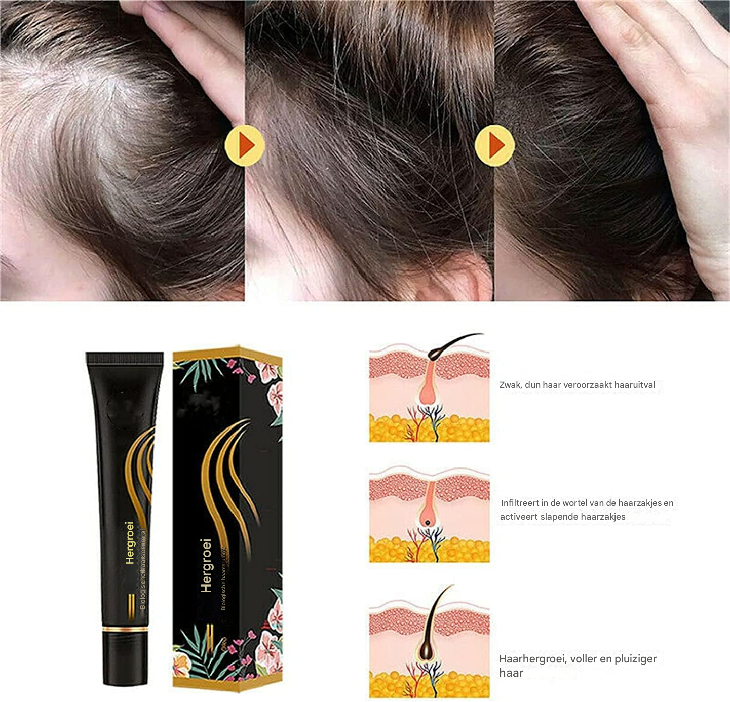 Follicyn™ - Biologisch haarserum roller [1 + 1 Gratis]