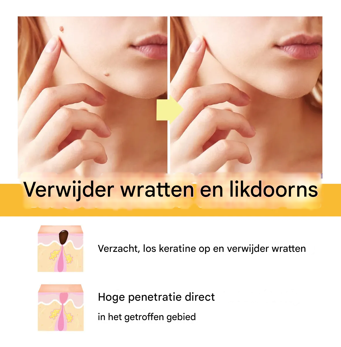 BeeNaturale™ – Verwijdert huidflapjes en vlekken zacht en effectief [1 + 1 Gratis]