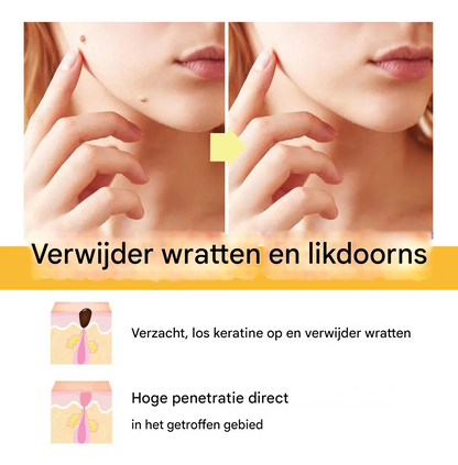 BeeNaturale™ – Verwijdert huidflapjes en vlekken zacht en effectief [1 + 1 Gratis]