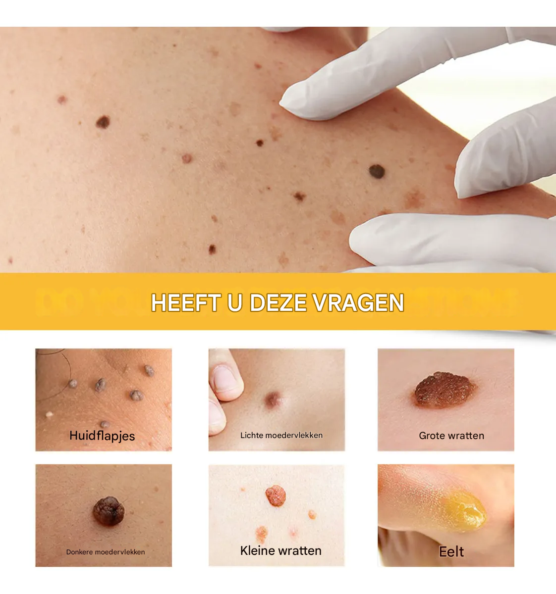 BeeNaturale™ – Verwijdert huidflapjes en vlekken zacht en effectief [1 + 1 Gratis]