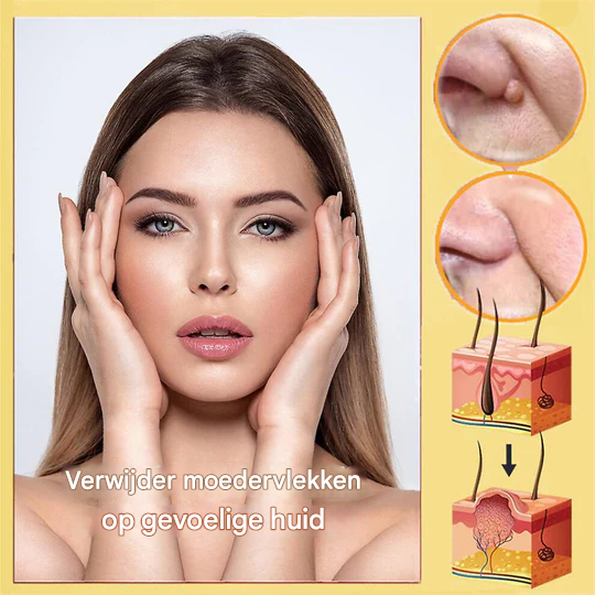 BeeNature™ – Verwijdert huidflapjes en vlekken zacht en effectief [1 + 1 Gratis]
