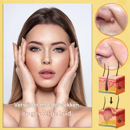 BeeNaturale™ – Verwijdert huidflapjes en vlekken zacht en effectief [1 + 1 Gratis]