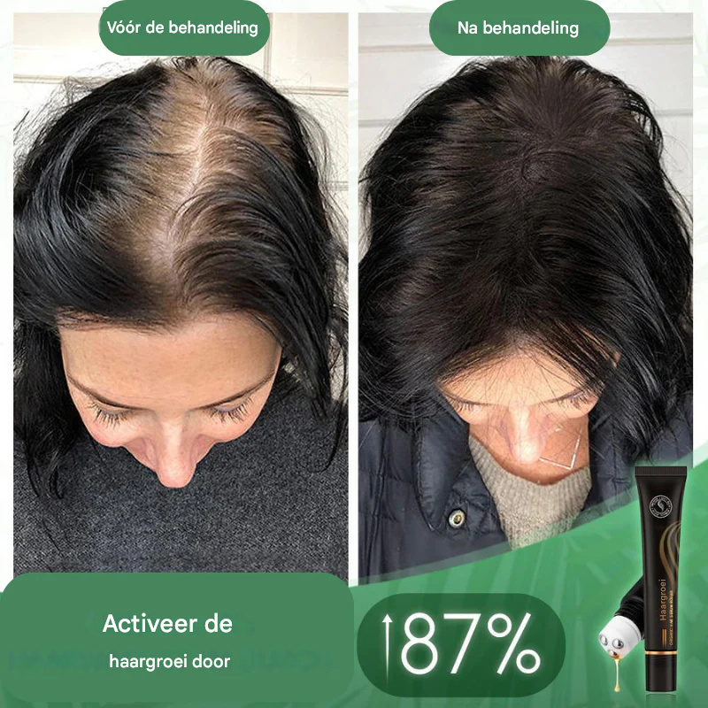 Follicyn™ - Biologisch haarserum roller [1 + 1 Gratis]