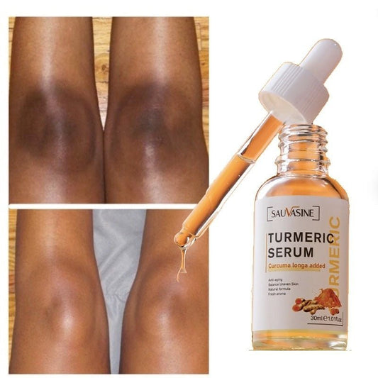 Sauvasine™ – Stralende, verzorgde huid zichtbaar in slechts enkele dagen [50% Korting]