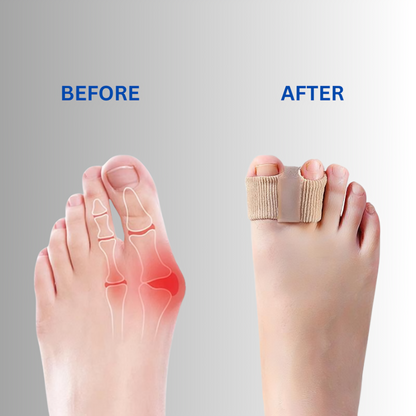 ToeCorrect™ – Zachte correctie van hallux & overlappende tenen [2 + 2 Gratis]