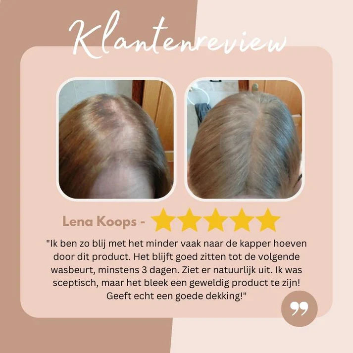 50% Korting | EasyBlend™  Dekt haaruitgroei onmiddelijk [Laatste dag Korting]